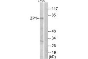 Western Blotting (WB) image for anti-Zona Pellucida Glycoprotein 1 (ZP1) (AA 221-270) antibody (ABIN2890710) (ZP1 anticorps  (AA 221-270))