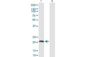 Western Blot analysis of CALML6 expression in transfected 293T cell line by CALML6 MaxPab polyclonal antibody. (CALML6 anticorps  (AA 1-181))