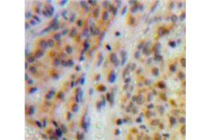 Used in DAB staining on fromalin fixed paraffin-embedded Ovary tissue (TOP2 anticorps  (AA 923-1148))