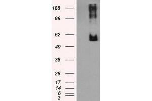 HEK293T cells were transfected with the pCMV6-ENTRY control (Left lane) or pCMV6-ENTRY LIPG (Right lane) cDNA for 48 hrs and lysed. (LIPG anticorps)