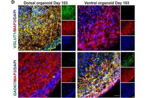 Images of dorsal and ventral forebrain organoids immunostained for VGlut1 (cat.