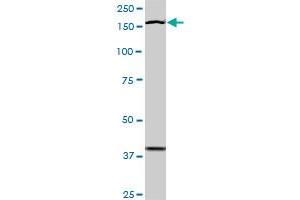 Western Blotting (WB) image for anti-TEK Tyrosine Kinase, Endothelial (TEK) (AA 66-185) antibody (ABIN793004) (TEK anticorps  (AA 66-185))