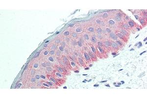 Immunohistochemistry of paraffin-embedded Human Skin using NECTIN4 Polyclonal Antibody at dilution of 1:90. (PVRL4 anticorps)