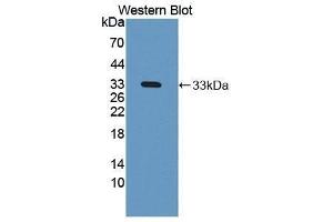 Western Blotting (WB) image for anti-N-Acetyl alpha-D-Glucosaminidase (AA 485-743) antibody (ABIN1869393) (N-Acetyl alpha-D-Glucosaminidase (AA 485-743) anticorps)