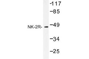 Image no. 1 for anti-Tachykinin Receptor 2 (TACR2) antibody (ABIN317655) (TACR2 anticorps)