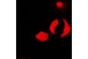 Immunofluorescent analysis of PP1 beta staining in U2OS cells. (Serine/threonine-Protein Phosphatase PP1-beta Catalytic Subunit (PP1-BETA) anticorps)