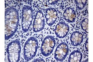 Image no. 1 for anti-Mucin 16, Cell Surface Associated (CA125) (AA 10329-10628) antibody (ABIN1490812)