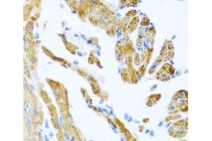 Immunohistochemistry of paraffin-embedded Mouse heart using COL9A3 Polyclonal Antibody at dilution of 1:100 (40x lens). (COL9A3 anticorps)