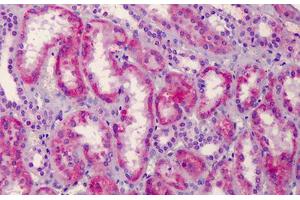 Human Kidney: Formalin-Fixed, Paraffin-Embedded (FFPE)