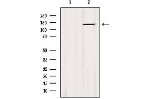 Western blot analysis of extracts from B16F10, using QSK Antibody. (SIK3 anticorps  (Internal Region))