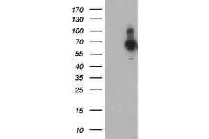 Western Blotting (WB) image for anti-PDZ and LIM Domain 5 (PDLIM5) antibody (ABIN1500133) (PDLIM5 anticorps)