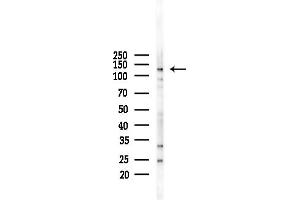 Western blot analysis of lysates from LoVo cells(heat-shock,45 min treatment), using CAR Antibody at 1/1000 dilution.