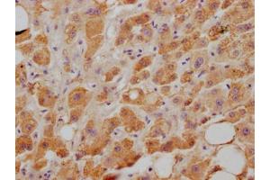 IHC image of ABIN7127645 diluted at 1:100 and staining in paraffin-embedded human liver tissue performed on a Leica BondTM system. (Recombinant NPC1L1 anticorps)