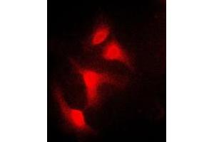 Immunofluorescent analysis of IKB alpha staining in HeLa cells. (NFKBIA anticorps  (N-Term))