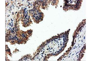 Image no. 5 for anti-IlvB (Bacterial Acetolactate Synthase)-Like (ILVBL) antibody (ABIN1498878) (ILVBL anticorps)