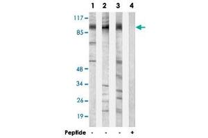 Western blot analysis of extracts from MCF-7 cells (Lane 1 and lane 4), 293 cells (Lane 2) and Jurkat cells (Lane 3), using N4BP1 polyclonal antibody . (N4BP1 anticorps)