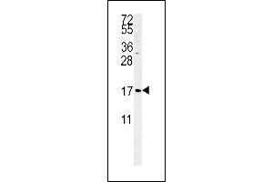 SGP Antibody (Center)&65288,Cat(ABIN651464 and ABIN2840255)&65289,western blot analysis in K562 cell line lysates (35 μg/lane). (SMAGP anticorps  (AA 46-75))
