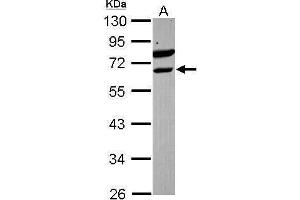 WB Image Sample (30 ug of whole cell lysate) A: Raji 10% SDS PAGE antibody diluted at 1:1000 (ETV6 anticorps)