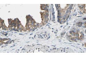 ABIN6272548 at 1/100 staining Human prostate tissue by IHC-P.