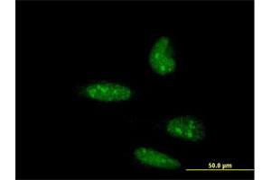 Immunofluorescence of monoclonal antibody to ATOH1 on HeLa cell. (ATOH1 anticorps  (AA 266-354))