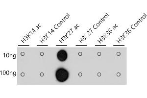 Dot-blot analysis of all sorts of peptides using Acetyl-Histone H3-K27 antibody (ABIN3016650, ABIN3016651, ABIN3016652, ABIN1682513 and ABIN1682514) at 1:1000 dilution.