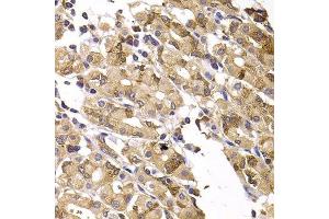Immunohistochemistry of paraffin-embedded human gastric injury using ASMTL antibody.