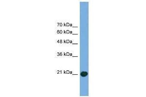 COMMD8 antibody used at 0. (COMMD8 anticorps  (Middle Region))