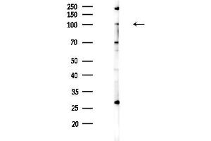 anti-Minichromosome Maintenance Deficient 10 (MCM10) (C-Term) antibody