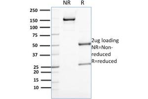 SDS-PAGE Analysis Purified Annexin A1 Mouse Monoclonal Antibody (CPTC-ANXA1-1).