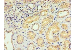 Immunohistochemistry of paraffin-embedded human kidney tissue using ABIN7142904 at dilution of 1:100 (AKAP13 anticorps  (AA 1-150))