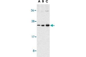Western blot analysis of TNFSF13 expression in Jurkat cells with TNFSF13 polyclonal antibody  at 1 ug/mL (A), 2 ug/mL (B), and 4 ug/mL (C). (TNFSF13 anticorps  (C-Term))