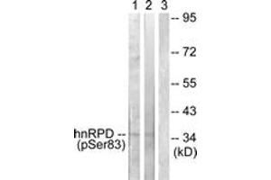 Western blot analysis of extracts from HuvEc and 293 cells, using hnRPD (Phospho-Ser83) Antibody. (HNRNPD/AUF1 anticorps  (pSer83))