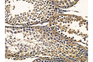 anti-Exophilin 5 (EXPH5) (C-Term) antibody