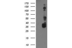 Western Blotting (WB) image for anti-BAI1-Associated Protein 2 (BAIAP2) antibody (ABIN1496805) (BAIAP2 anticorps)