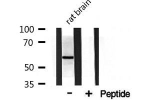 Western blot analysis on rat brain lysate using DOK3 Antibody (DOK3 anticorps  (Internal Region))