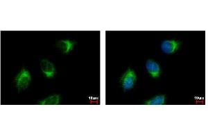 ICC/IF Image GGA3 antibody [C3], C-term detects GGA3 protein at Golgi apparatus by immunofluorescent analysis.