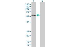 Western Blot analysis of EPB41 expression in transfected 293T cell line by EPB41 MaxPab polyclonal antibody. (EPB41 anticorps  (AA 1-720))