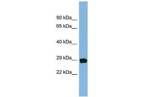 WB Suggested Anti-CHCHD3 Antibody Titration: 0. (CHCHD3 anticorps  (N-Term))