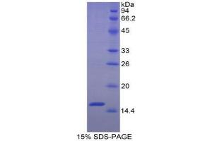 SDS-PAGE analysis of Mouse Diamine Oxidase Protein.