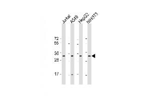 All lanes : Anti-RPS2 Antibody (C-Term) at 1:2000 dilution Lane 1: Jurkat whole cell lysate Lane 2: A549 whole cell lysate Lane 3: HepG2 whole cell lysate Lane 4: NIH/3T3 whole cell lysate Lysates/proteins at 20 μg per lane. (RPS2 anticorps  (AA 248-379))