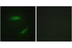 Immunofluorescence analysis of HepG2 cells, using CD4 (Phospho-Ser433) Antibody. (CD4 anticorps  (pSer433))