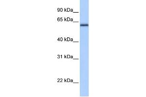 WB Suggested Anti-ZBTB26 Antibody Titration:  0. (ZBTB26 anticorps  (C-Term))