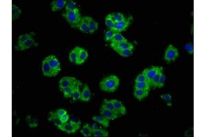Immunofluorescence staining of HepG2 cells with ABIN7146190 at 1:100, counter-stained with DAPI. (E-cadherin anticorps  (AA 153-641))