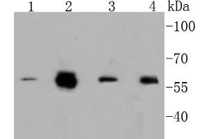 Lane 1: A549, Lane 2: HCT116, Lane 3: Hela, Lane 4: HepG2 cell lysates, probed with c-Myc(S62) (1A7 ) Monoclonal Antibody  at 1:1000 overnight at 4˚C. (c-MYC anticorps  (pSer62))