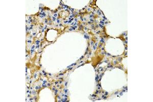 Immunohistochemistry of paraffin-embedded rat lung using IL9 antibody. (IL-9 anticorps)