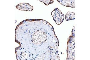 IHC analysis of Rab4/RAB4A using anti-Rab4/RAB4A antibody (ABIN7599733). (Rab4 anticorps  (AA 110-216))