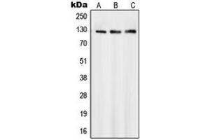 Western blot analysis of SMG7 expression in Jurkat (A), A431 (B), HeLa (C) whole cell lysates. (SMG7 anticorps  (Center))