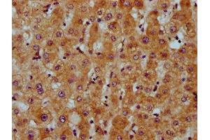 IHC image of ABIN7163112 diluted at 1:200 and staining in paraffin-embedded human liver tissue performed on a Leica BondTM system. (CDS2 anticorps  (AA 354-445))