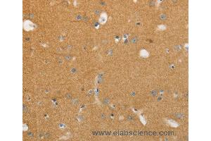 Immunohistochemistry of Human brain using NFASC Polyclonal Antibody at dilution of 1:30 (NFASC anticorps)