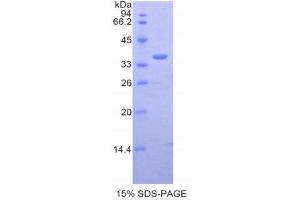 SDS-PAGE (SDS) image for Chemokine (C-X-C Motif) Ligand 13 (CXCL13) (AA 22-109) protein (His tag,GST tag) (ABIN1877820)
